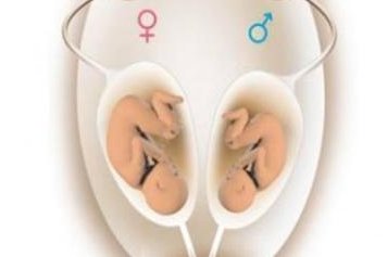 库车试管婴儿（在新疆做试管婴儿那家里院对好）